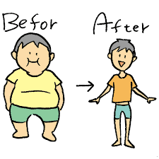 before-after